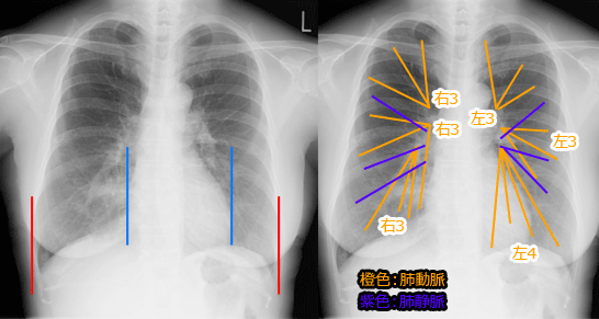 心胸比と肺紋理
