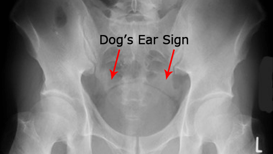 dog's-ear-sign