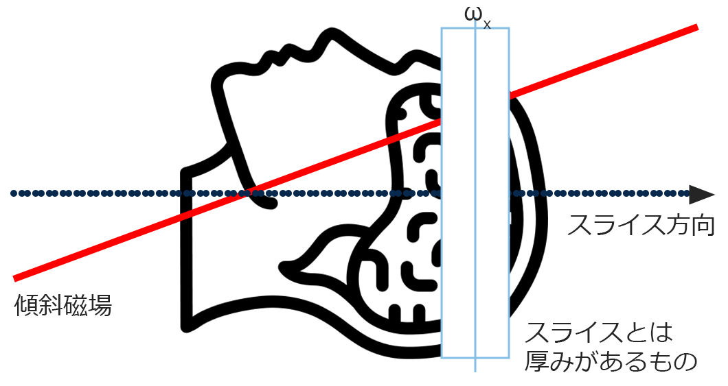 スライス厚の概念